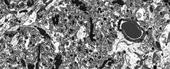 Molecules imaging